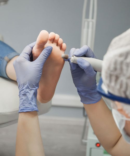 Foot Care Nursing Services Foot Care Nursing Services